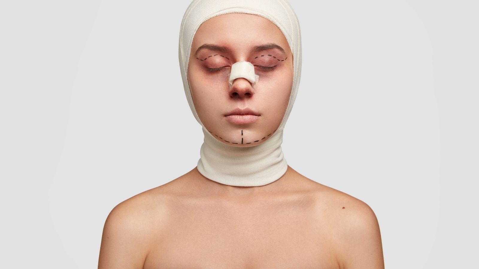 Burun Ameliyatından Sonra Burundan Dikiş İpi Sarkması