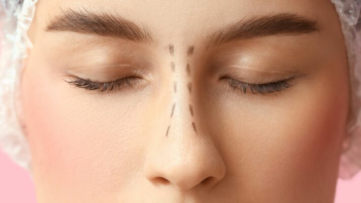 Burun Ameliyatı Öncesi Yapılması Gerekenler